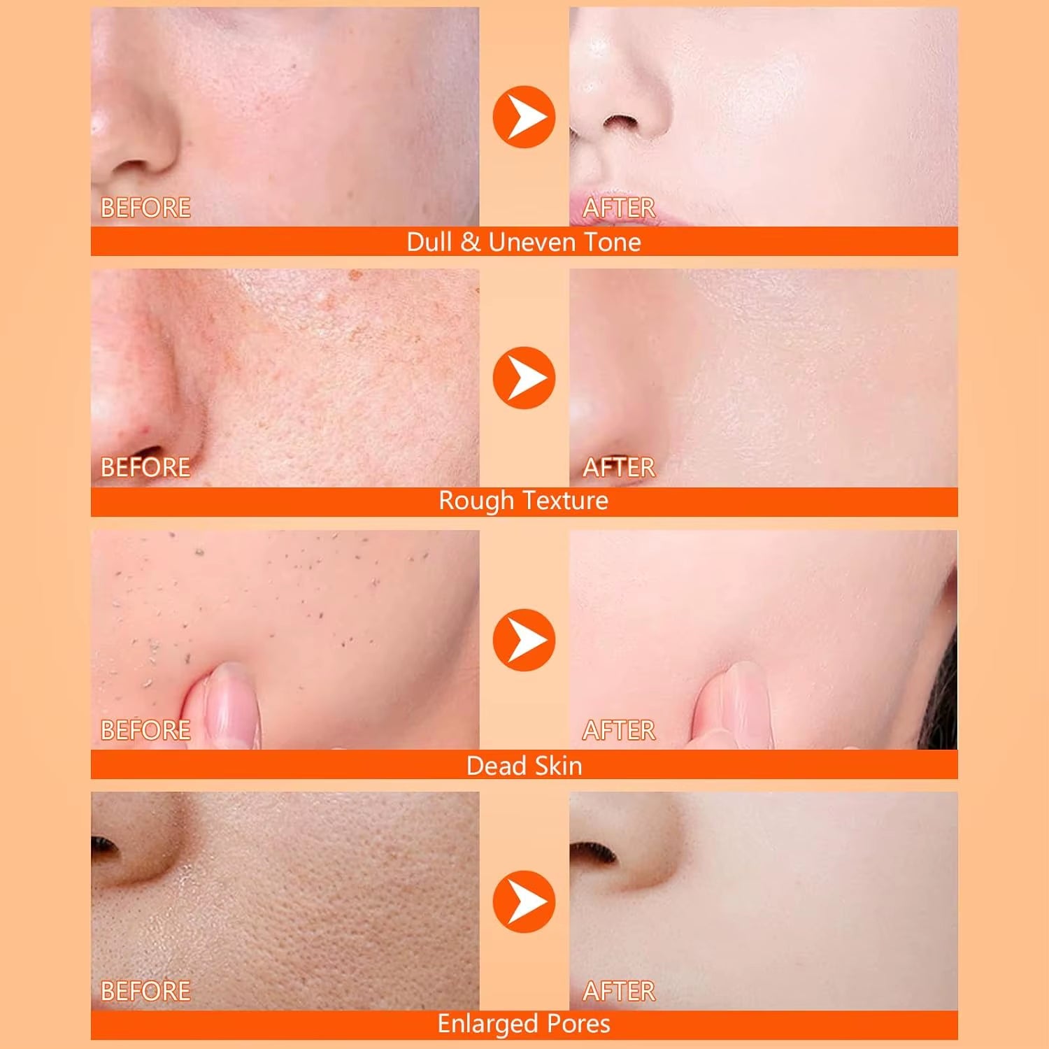 Body Keratin Care Kojic Acid Turmeric Spray Gently Exfoliating Peeling Solution Nourishing Hydrating Skin Care All Skin Types