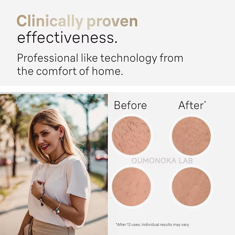 Permanent Laser Hair Removal Bikini Women'S IPL Depilators Shaver Facial Hair Cutting Machine Men'S Razo to Remove Hair Trimmer